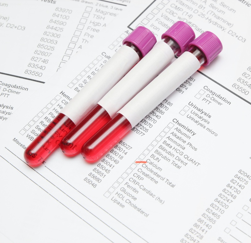 kleines blutbild check up labortests