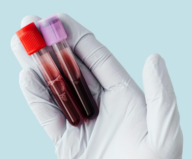 entzuendungswerte-blutanalyse